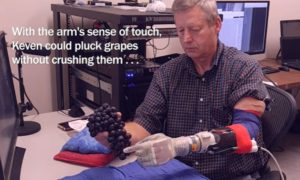 VIDEO – Amputirac dobio novu mehaničku ruku koju može pomjerati mislima