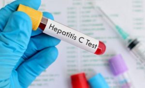 UKC RS: Rezultati testiranja na hepatitise