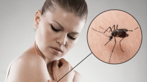 Prirodne metode: Evo kako možete smanjiti svrbež nakon uboda komarca