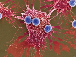 Da li bakterije mogu da ubiju ćelije raka?