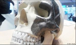 Dijelovi ljudskog tijela iz 3D-štampača