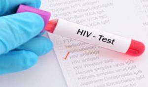 Od AIDS do sada umrlo 20 ljudi u RS: U četvrtak besplatno testiranje na HIV u Banjaluci