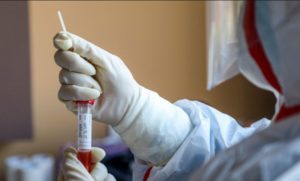 SZO: Povećati broj testiranja na virus korona u BiH
