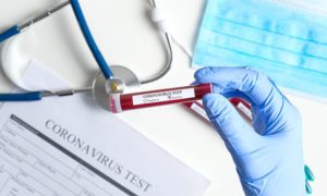 U RS na koronavirus pozitivno još 14 osoba, jedna osoba preminula