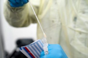 “Okupljanja najveći problem”: Korona virusom u Srpskoj zaraženo još 114 osoba