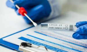 Poruka hrvatskog epidemiologa: Ne treba zbog svakog šmrcanja raditi PCR test