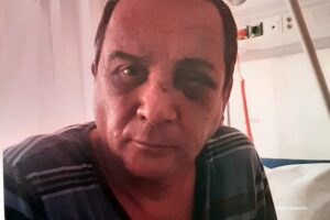 “Sudija ih nije kaznio već stimulisao”: Duška (56) brutalno pretukla trojica mladića u Banjaluci