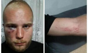 Uplašeni mladić se uzda u policiju: Uz psovanje “srpske majke” četvorica brutalno pretukla Petra