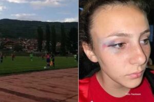 Masovne tuče fudbalerki na utakmici: Igračica Sane imala potres mozga FOTO