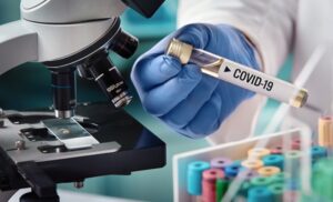 Istraživanja u UKC RS potvrdila sumnje: Korona virus ostavlja posljedice na plućima