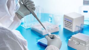 Nijedna privatna ambulanta ne može da vrši testiranje PCR metodom