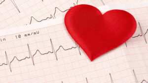 Prvi uzrok smrti u svijetu! Od kardiovaskularnih bolesti umre 17,5 miliona ljudi godišnje