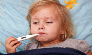 Apel roditeljima da vakcinišu djecu: Potvrđeni prvi slučajevi malih boginja u Srbiji