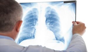 Nakon preležane korone: Doktor za oporavak pluća savjetuje pjevanje narodnih pjesama