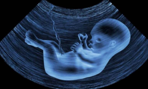 Naučnici zabrinuti: U posteljicama nerođenih beba otkrivene čestice mikroplastike