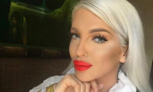 “Šta reći? Svjetska zvijezda kod mene…”: Jelena Karleuša ima nove usne FOTO