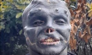 Uklonio nos i gornju usnu: Zaljubljenik u transformaciju želi da postane “crni vanzemaljac” VIDEO