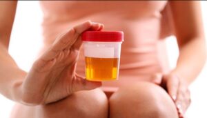 Kako pobijediti urinarnu infekciju i ešerihiju koli