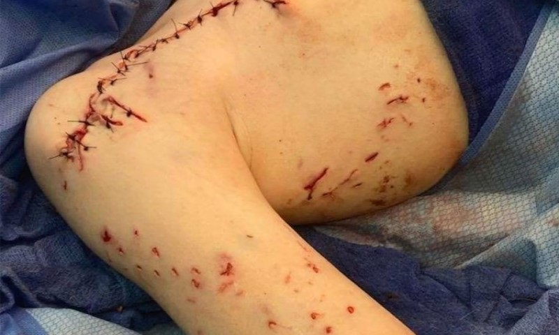 “Ajkula je pokušala da me pojede”: Opasna neman napala devetogodišnjaka VIDEO