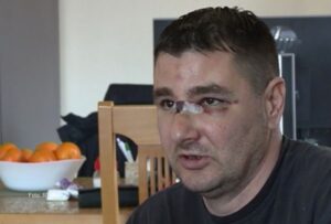 Pretučen na kućnom pragu: Tvrdi da je razlog što se izjašnjava kao Srbin VIDEO