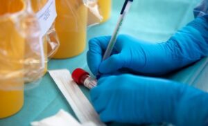 Testiranje otkrilo: U Zagrebu 25 odsto zaraženih ima britanski soj korona virusa