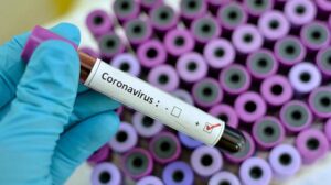 U Srpskoj koronavirus potvrđen kod još 72 pacijenta, 13 osoba preminulo