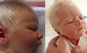 Medicinski fenomen: Rođena beba sa bijelom kosom i preslatka je VIDEO