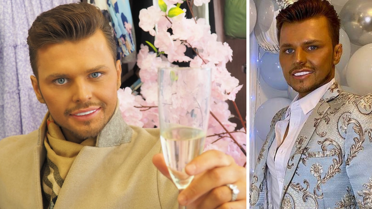 Ljudska “Ken lutka”: Britanac Džimi želi izgledati što plastičnije VIDEO