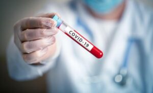Preminula dva pacijenta u FBiH: Na virus korona pozitivno još 256 osoba