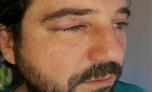 Srpski glumac dobio šaku u glavu: Muškarac ga udario jer je negativac u seriji