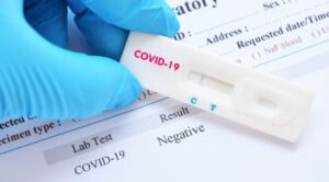 U Srpskoj testirano 196 uzoraka: Virus potvrđen kod četiri osobe, nema preminulih