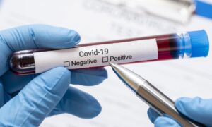 U Srbiji borbu izgubio 51 pacijent, koronavirus potvrđen kod još 2.648 osobe