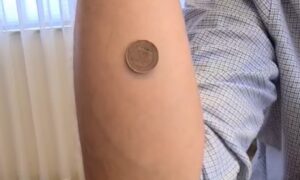 Začepio usta antivakserima: Rajčević objasnio zašto se novčić lijepi za ljudsko tijelo VIDEO