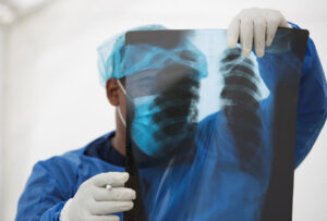 Doktor objavio rendgen snimak: Evo kako izgledaju pluća vakcinisanih i nevakcinisanih FOTO