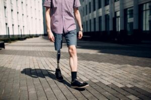Čovjeku bez noge tražili dokaz o invaliditetu, poruka njegovog ljekara nasmijala sve