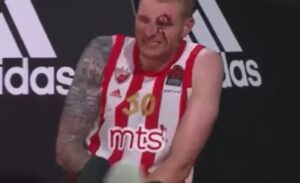 Stravična povreda košarkaša Crvene Zvezde VIDEO