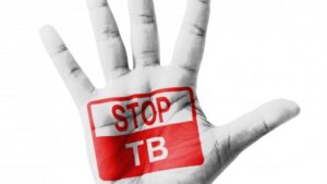 Crveni krst RS: Nedjelja borbe protiv tuberkuloze