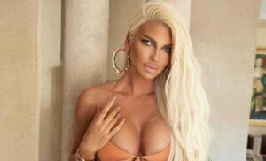 Mnogi nisu znali! Jelena Karleuša ima ozbiljan zdravstveni problem o kojem nikada ne priča