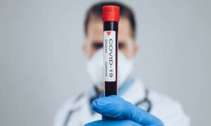 Blijeda slika korone u Srpskoj: Virus potvrđen kod još 10 osoba