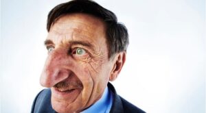 Ginisov rekord: Ovaj čovjek ima najveći nos na svijetu FOTO