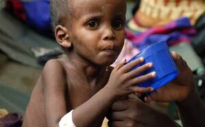 Upozorenje ljudi iz struke: Neuhranjenost bi mogla “odnijeti živote” više od milion djece