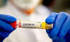 Preminula četiri pacijenta: Korona virus potvrđen kod još 137 osoba u Srpskoj