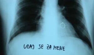 Kakva prosidba: Uz snimak pluća i prsten, dovitljivi Gabrijel zaprosio doktorku Tamaru VIDEO