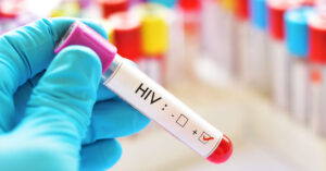 U BiH HIV-om zaražena 41 osoba