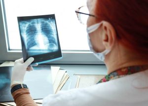 Građanima se pruža bolja usluga: Nakon šest godina Hitna služba dobila rendgen