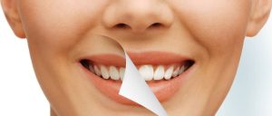 Nekoliko ključnih savjeta: Evo kako spriječiti stvaranje zubnog kamenca