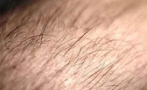 Jeste li se zapitali: Zašto na koži rastu dlake?