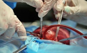 Njemački naučnici na važnom putu: Počinje uzgoj svinja – donora za transplantaciju srca