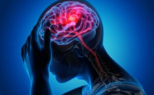 Kako da na vrijeme prepoznate simptome krvnog ugruška u mozgu?