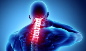 Bol u vratu: Ponekad je simptom ozbiljnog deformiteta kičme